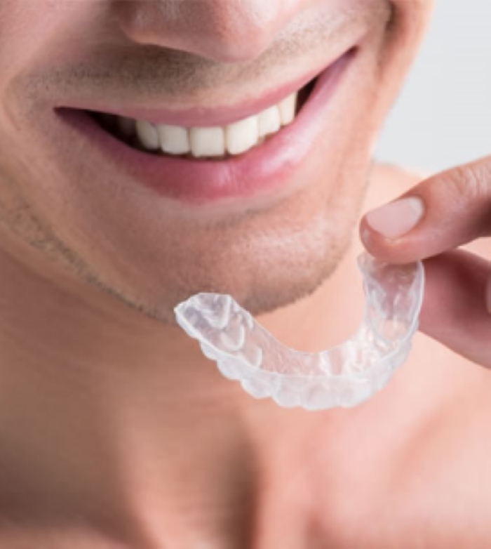 Man smiling and holding the Clear Aligners to his mouth