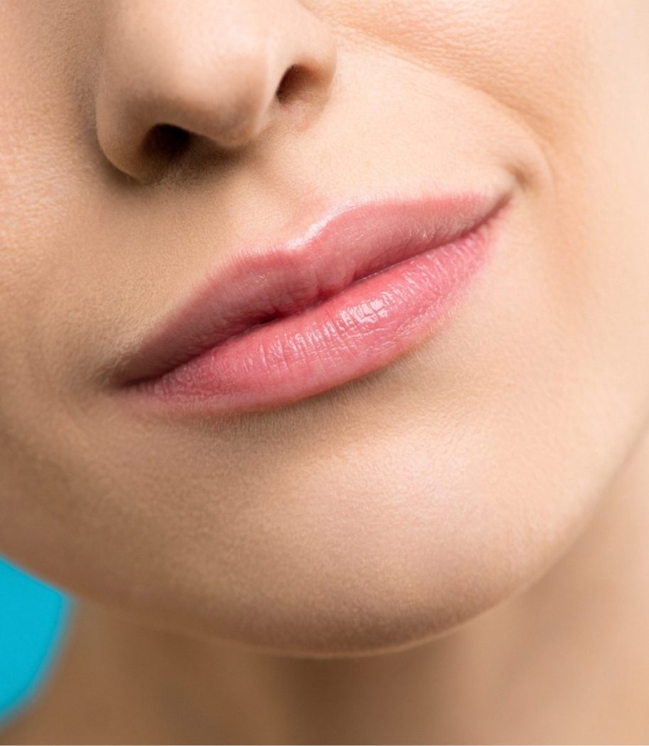 Lip fillers Procedure