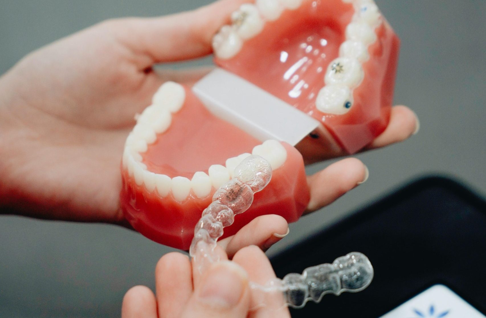 Invisalign aligners