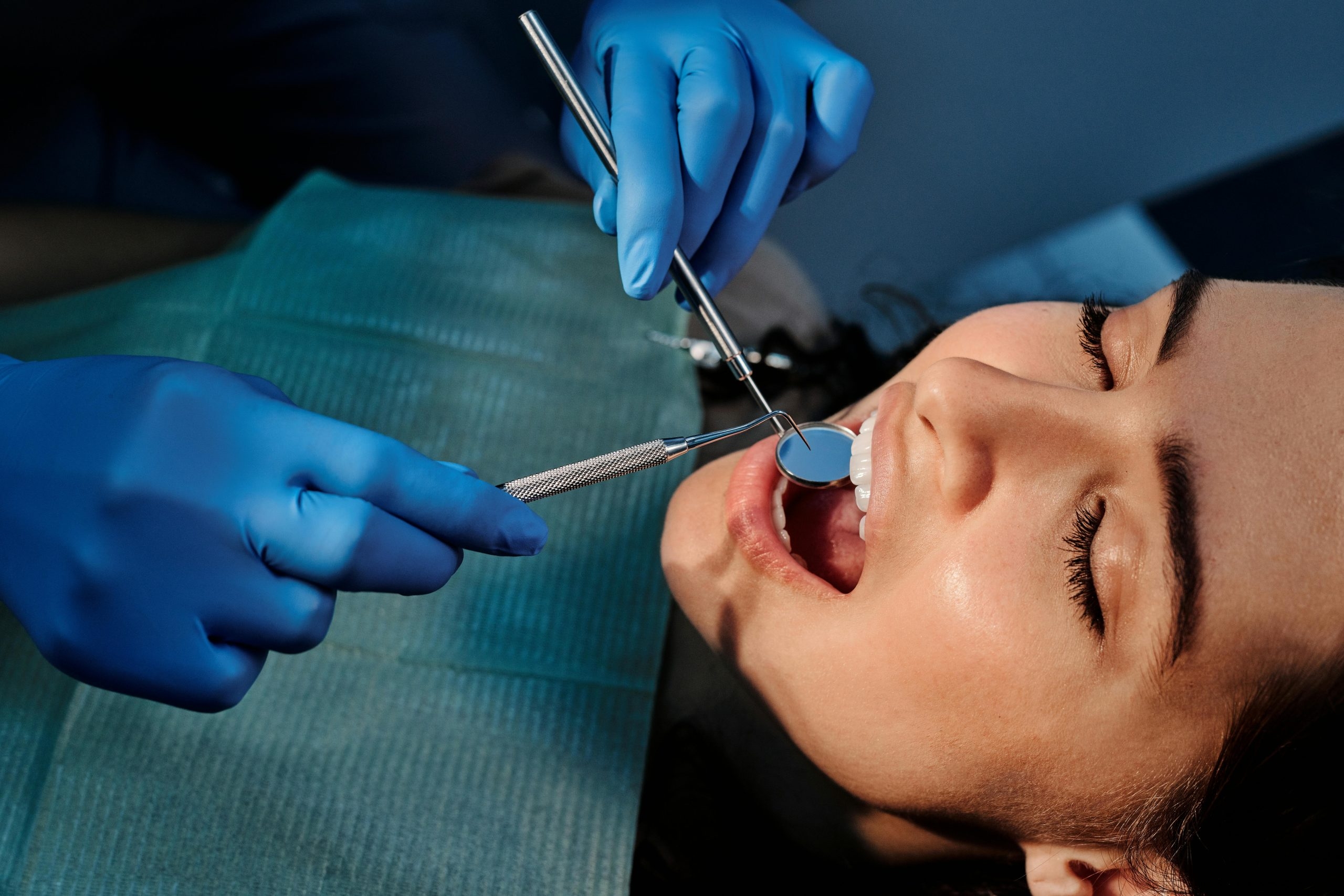 A Person Wearing Blue Latex Gloves Holding a Mirror in a Woman's Mouth at the Dentists